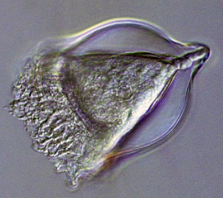 This Tintinnid is part of the group of microscopic aquatic organisms called �microzooplankton�