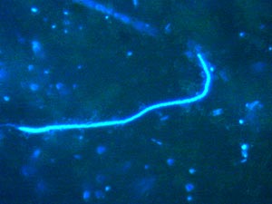  A photomicrograph (1000 times magnification) of stained bacterial cells. These were isolated from a sample “slurped” from around a clump of mussels. The long strand is a spirochete—a bacterium that moves in a corkscrew motion. The bright dots are also bacteria; however, they cannot be identified without the use of molecular techniques. 