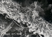 bacteriaobe