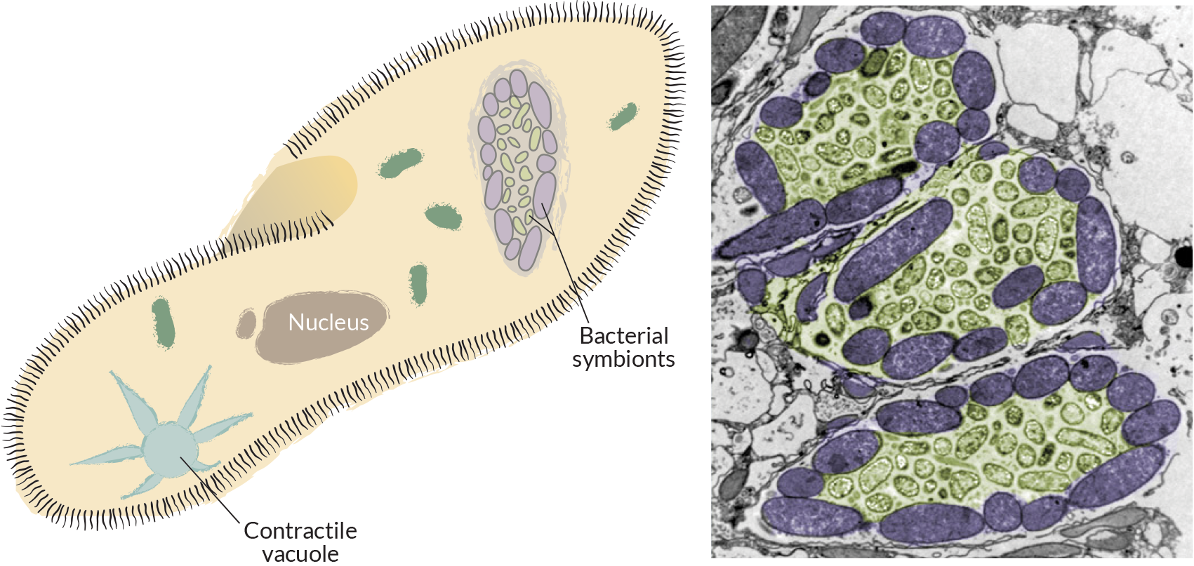 (Left) Diagram of a ciliate that hosts different kinds of bacteria in its cell. (Right) Colorized electron micrograph showing compartments inside a ciliate where different kinds of bacteria live. (Illustration by Jack Cook, photo by Virginia Edgcomb, Woods Hole Oceanographic Institution)