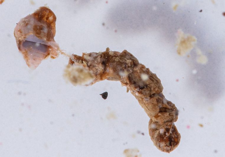A sample collected from TZEx includes a rare, intact fecal pellet, most likely from a fish. A pellet like this would likely sink very quickly, carrying carbon with it. Photo by David Liittschwager.
